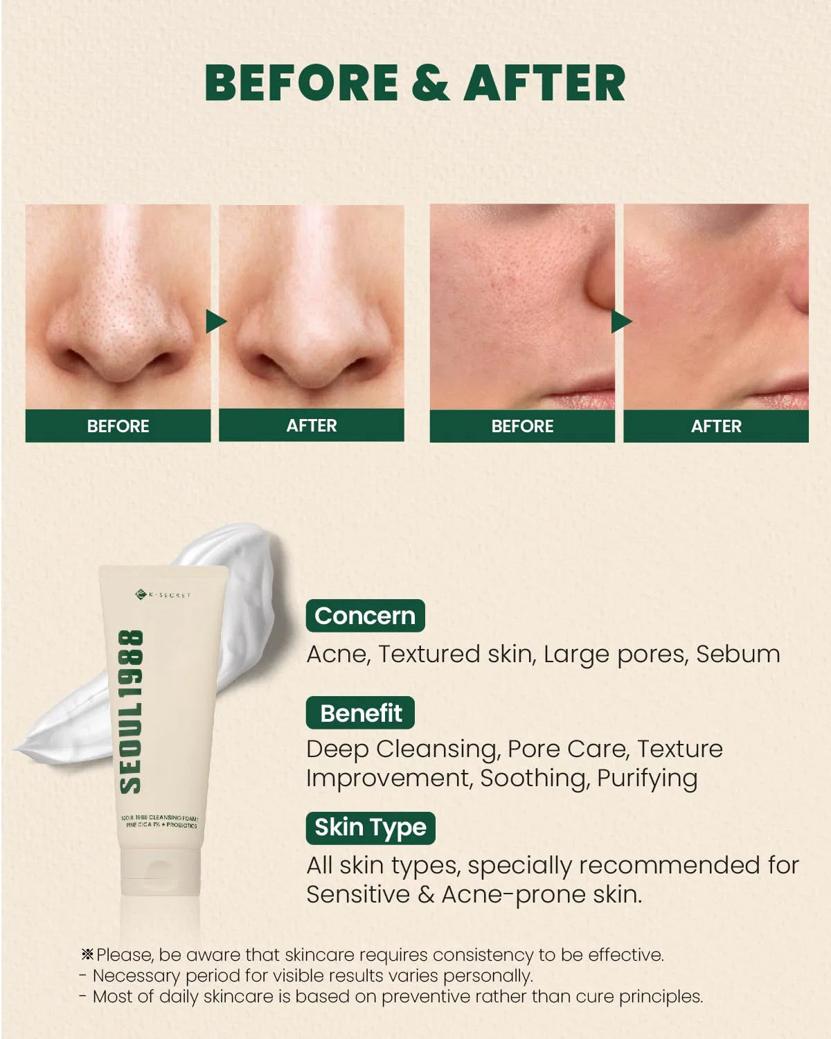 K-Secret Seoul 1988 Pine Cica 1% +Probiotics Cleansing Foam