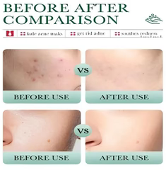 Bioaqua Salicylic Acid Cleanser