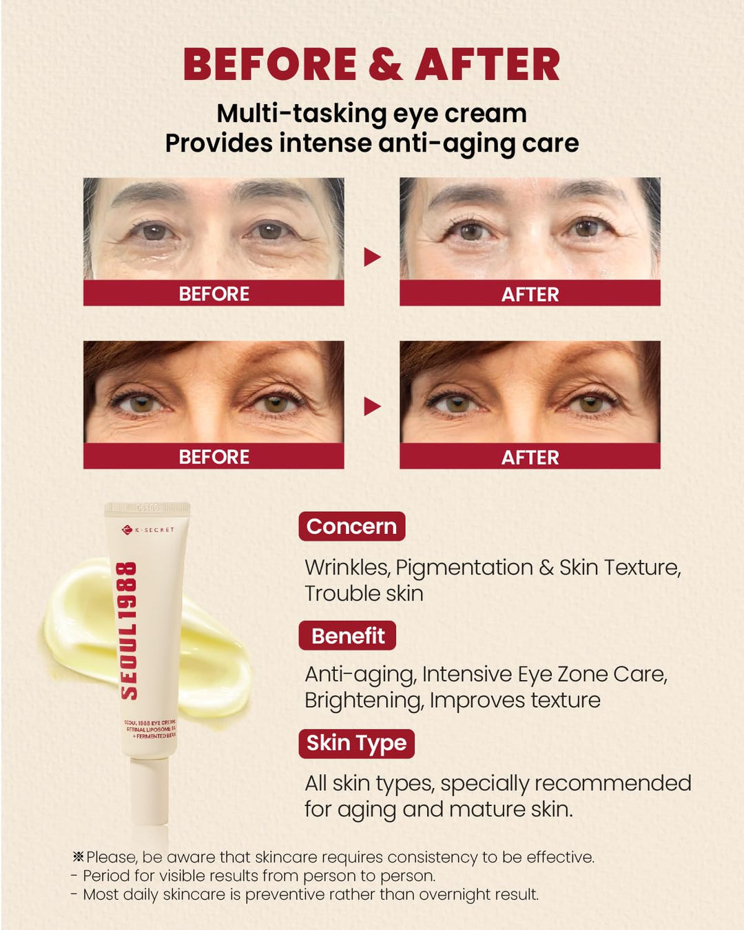KSECRET SEOUL1988 EYE CREAM : RETINAL LIPOSOME 4% + FERMENTED BEAN 30ML