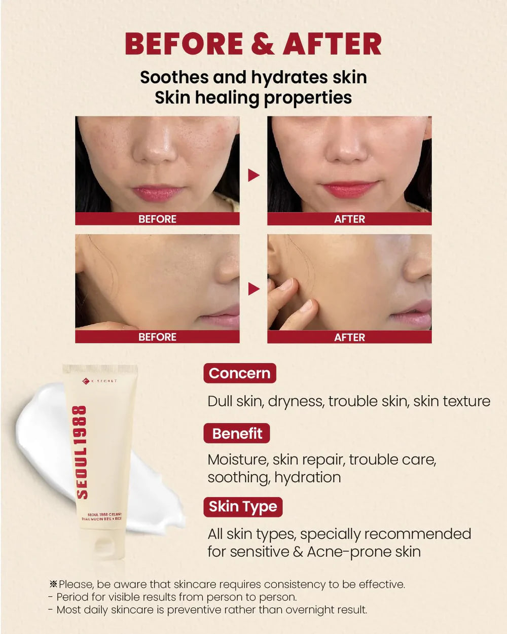 K-Secret Seoul 1988 Snail Mucin 93% + Rice Cream - 100ml - Made in Korea